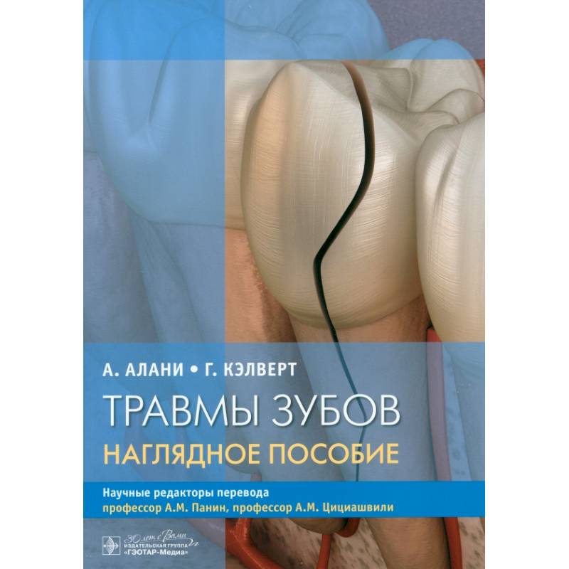 Травмы зубов. Наглядное пособие