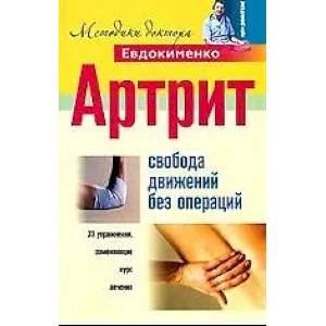 Артрит. Свобода движений без операций