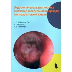 Эндоскопическая диагностика и лечение заболеваний пищевода, желудка и тонкой кишки