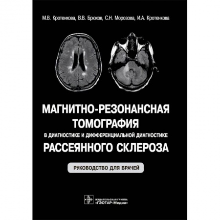 УЗИ. ЭКГ. Томография. Рентген, книга Магнитно-резонансная томография в диагностике и дифференциальной диагностике рассеянного склероза купить по скидке