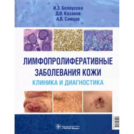 Кожные и венерические болезни, книга Лимфопролиферативные заболеванания кожи. Клиника и диагностика купить по скидке