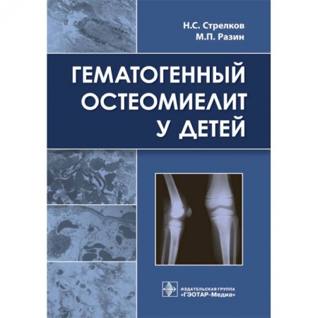 Медицина. Фармакология, книга Гематогенный остеомиелит у детей купить по скидке