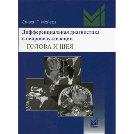 Позвоночник. Суставы. Артрит. Остеохондроз, книга Дифференциальная диагностика в нейровизуализации. Голова и шея купить по скидке