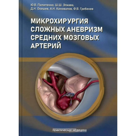 Хирургия. Ортопедия, книга Микрохирургия сложных аневризм средних мозговых артерий: гигантских, фузиформных и частично тромбированных купить по скидке