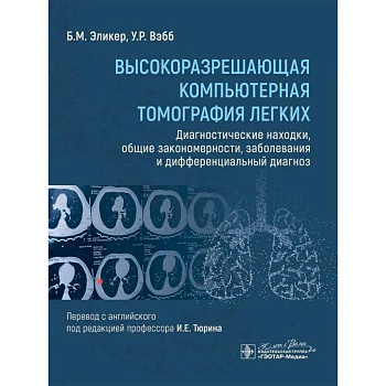 Высокоразрешающая компьютерная томография легких. Диагностические находки, общие закономерности, заболевания и дифференциальный диагноз